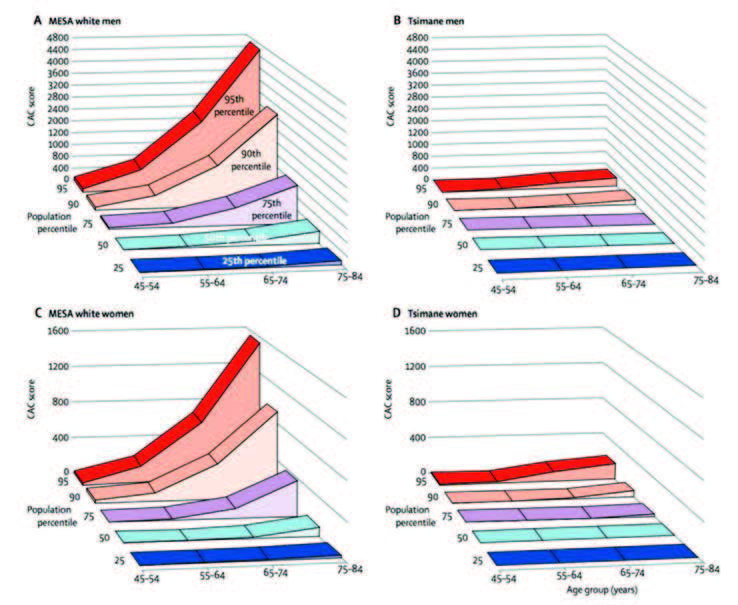 Figure 2. CAC score by age and CAC percentile in MESA white men (A) and Tsimane men and in MESA white women (C) and Tsimane women (D). Adapted with permission from Kaplan H, Thompson RC, Trumble BC, et al. Coronary atherosclerosis in indigenous South American Tsimane: a cross-sectional cohort study. The Lancet. 2017;389(10080):1730-1739.